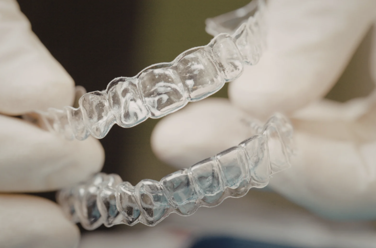 マウスピース矯正で失敗しないために|よくある原因と後悔を避けるための考え方