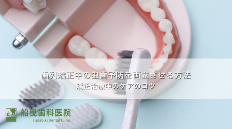 歯列矯正中の虫歯予防を両立させる方法〜矯正治療中のケアのコツ〜