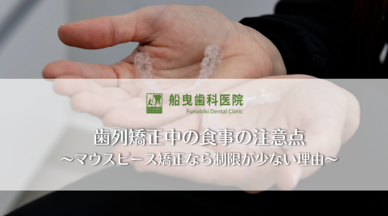 歯列矯正中の食事の注意点〜マウスピース矯正なら制限が少ない理由〜