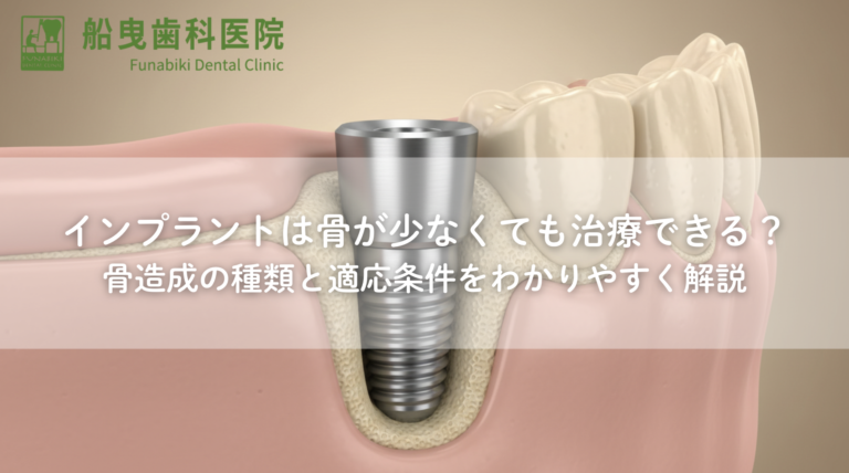 インプラントは骨が少なくても治療できる？骨造成の種類と適応条件をわかりやすく解説